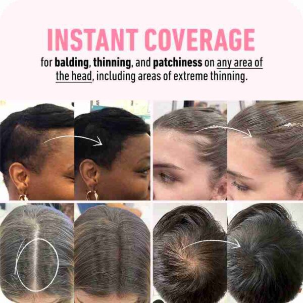 Hairline Powder - Root Touch Up Hair Color with 28% Off Deal - Image 2