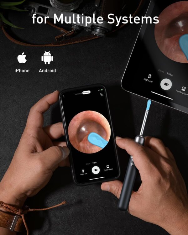 Ear Wax Removal Wireless WiFi Rechargeable with 10% Off (Limited time deal) - Image 2