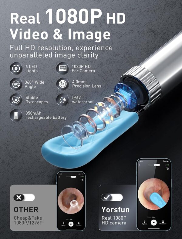 Ear Wax Removal Wireless WiFi Rechargeable with 10% Off (Limited time deal) - Image 3